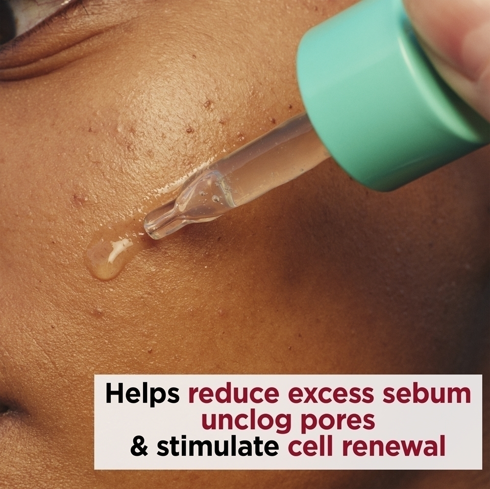 Моя сыворотка Clarins Pure-Reset Resurfacing Blemish Serum - это восстанавливающая сыворотка для жирной кожи, склонной к появлению акне. Clarins, 30 мл — фото 3