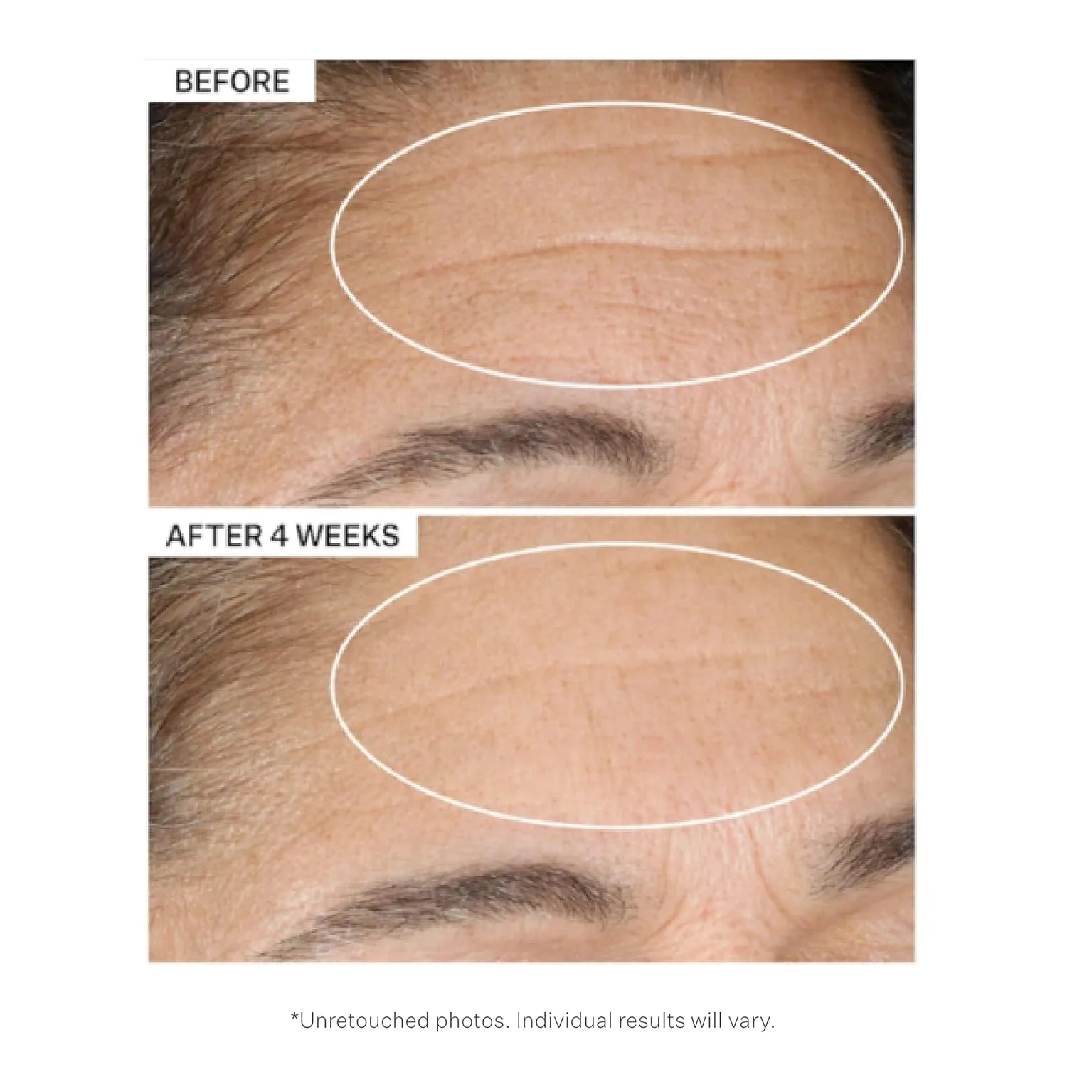 Крем для лица StriVectin — Advanced Retinol борется с видимыми признаками старения, делая кожу более здоровой — фото 3