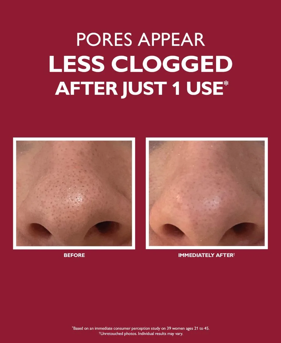 Крем для лица Peter Thomas Roth — Очищающее средство для микродермабразии Even Smoother Microdermabrasion Exfoliating Pore — фото 2