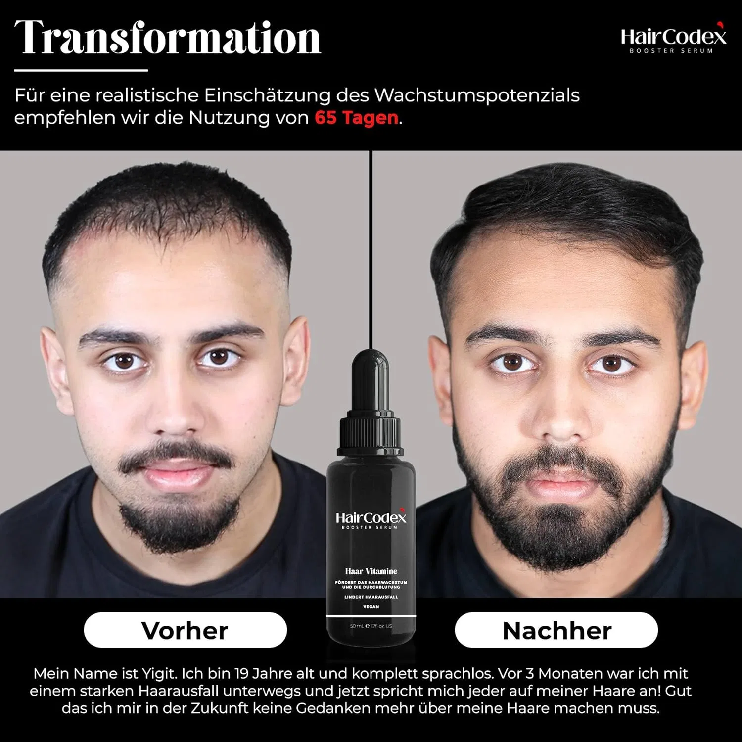 Набор для роста волос Booster Serum с дермароллером, 50 мл Haircodex — фото 4