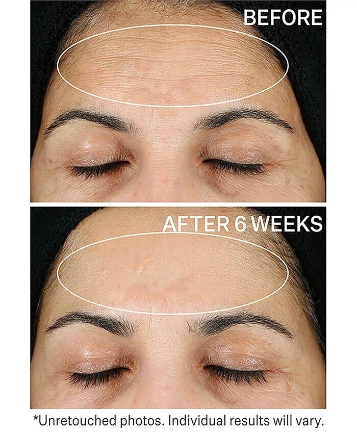 Сыворотка StriVectin — Super C Retinol Осветляющая и корректирующая с витамином С — фото 3