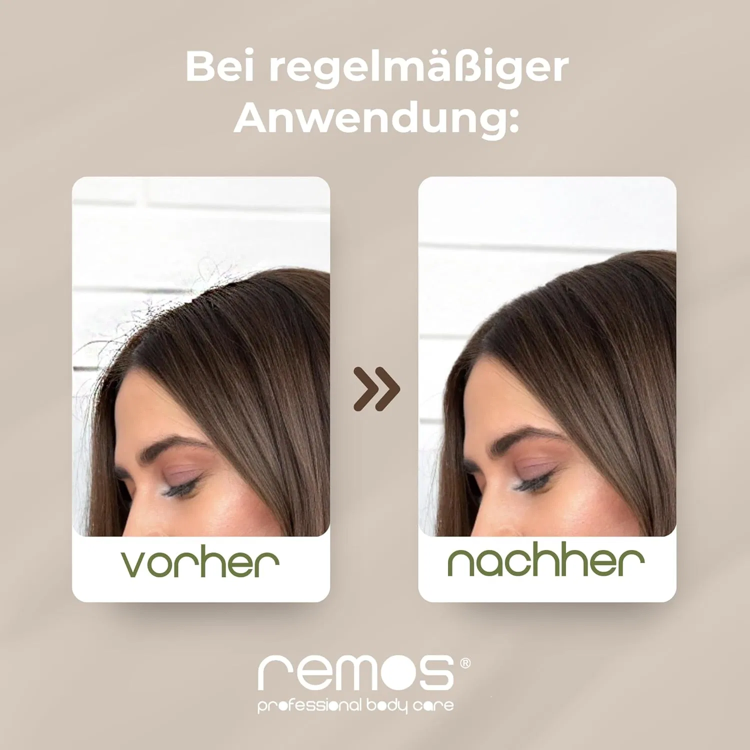 Щетка для волос remos из грушевого дерева с натуральной щетиной кабана Remos Professional Body Care, Brown — фото 4