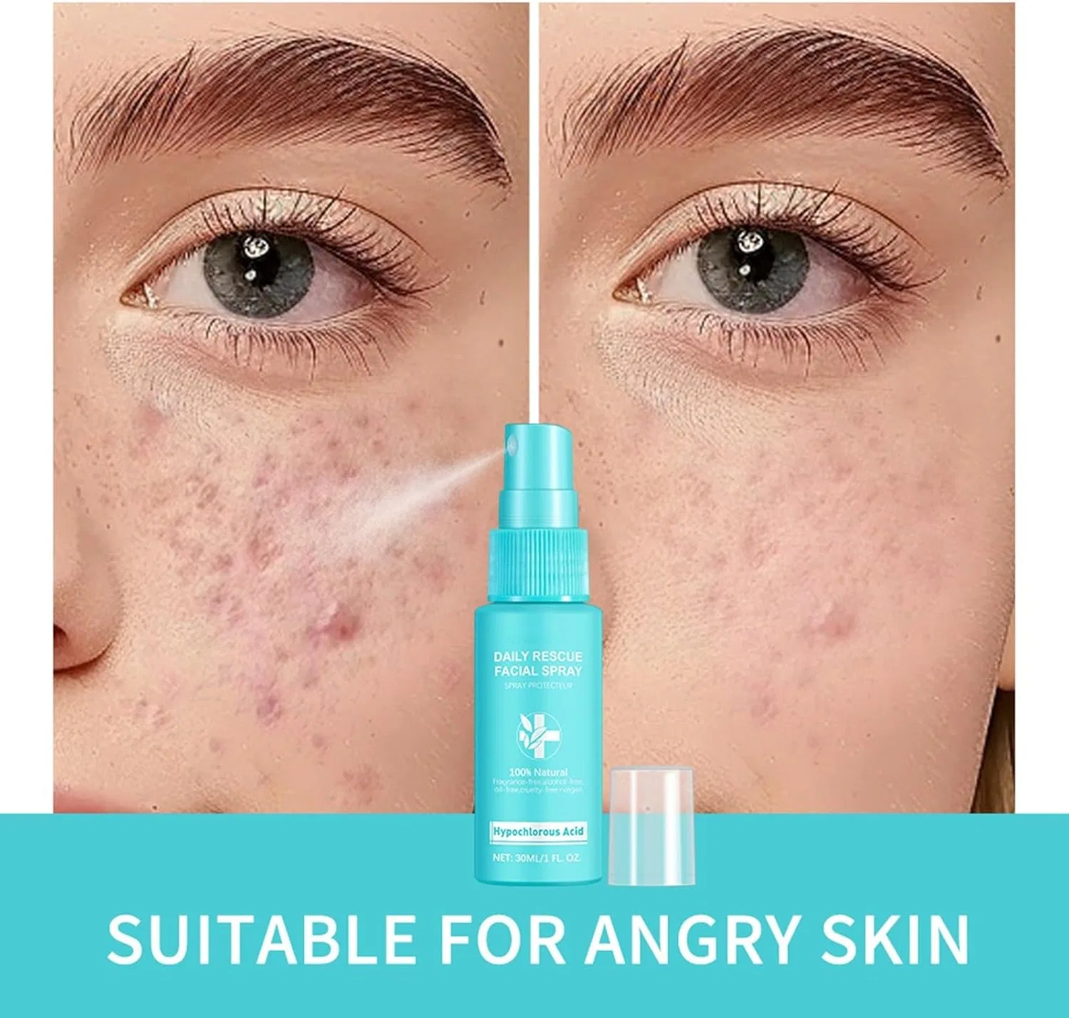 Тоник — Спрей- Skin Renew с хлорноватистой кислотой, . Generisch, 1 Pc — фото 4