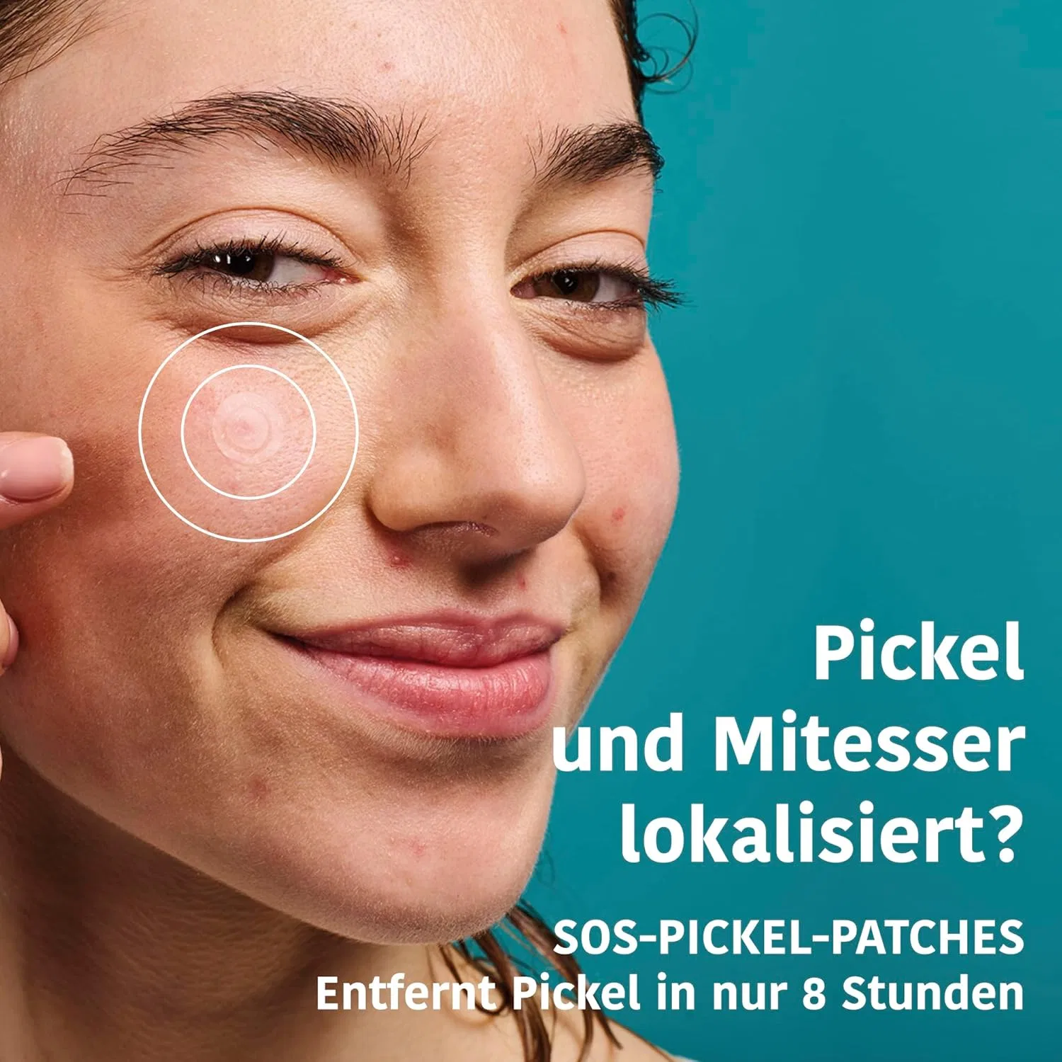 Набор Iroha Nature Intensive Anti Imperfection Pack для кожи, склонной к акне Iroha Nature — фото 3