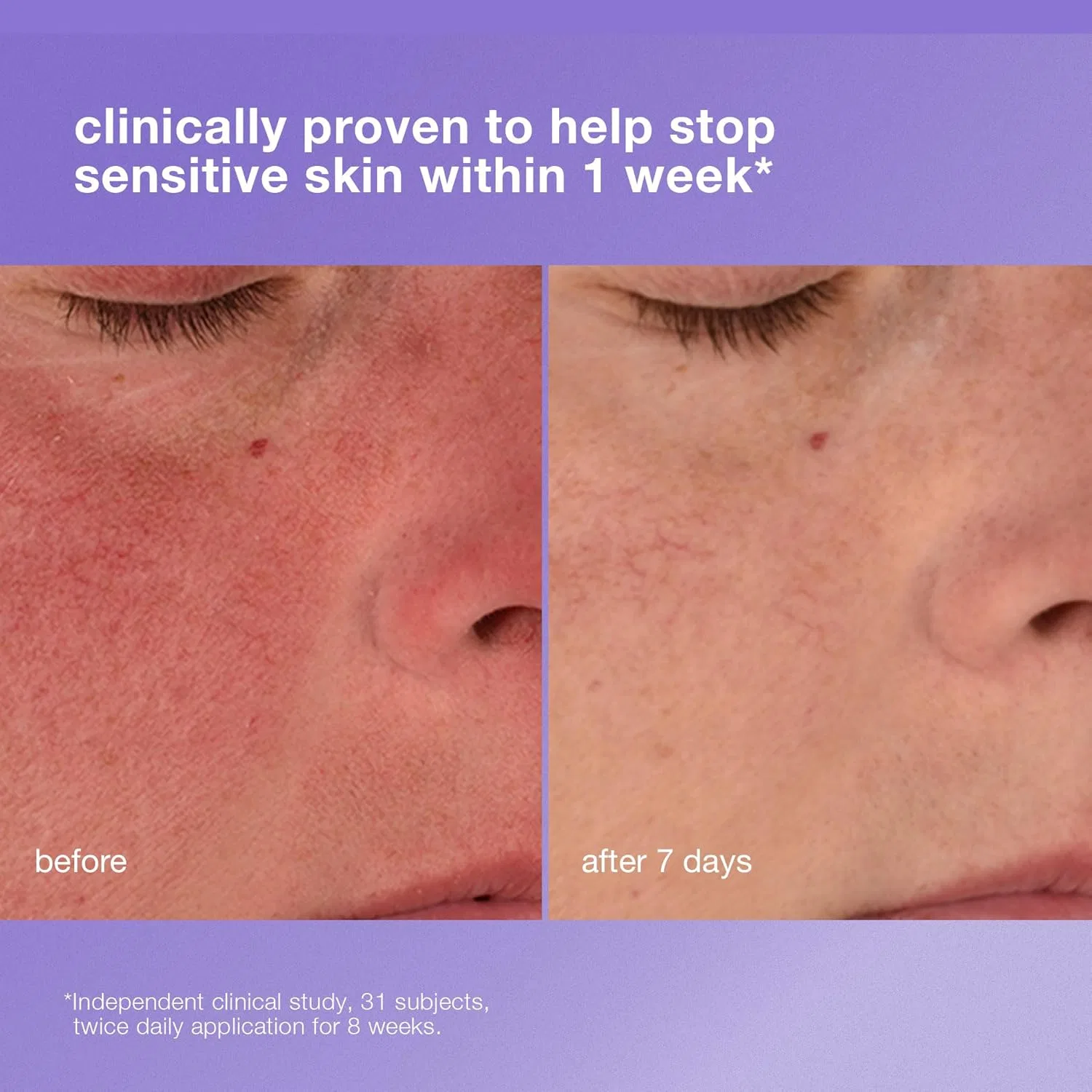 Успокаивающий восстанавливающий крем Dermalogica Stabilizing Repair Cream (100 мл) Dermalogica — фото 3