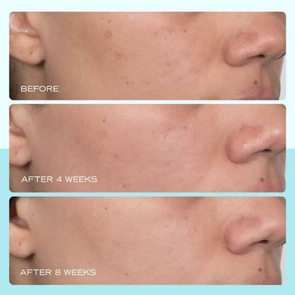 Сыворотка First Aid Beauty — От темных пятен с ниацинамидом — фото 4