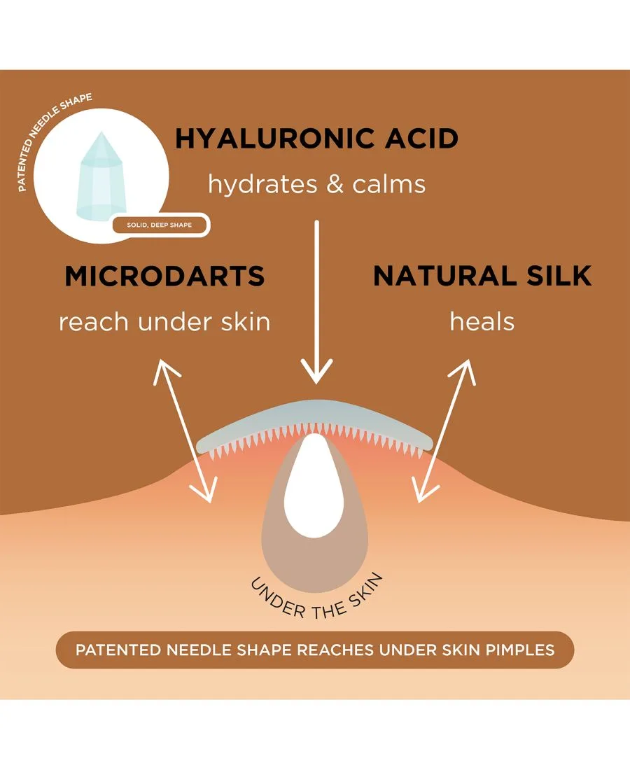 NIGHT Пластыри от прыщей Silk + Salicylic Acid Microdart, упаковка из 48 штук — фото 2