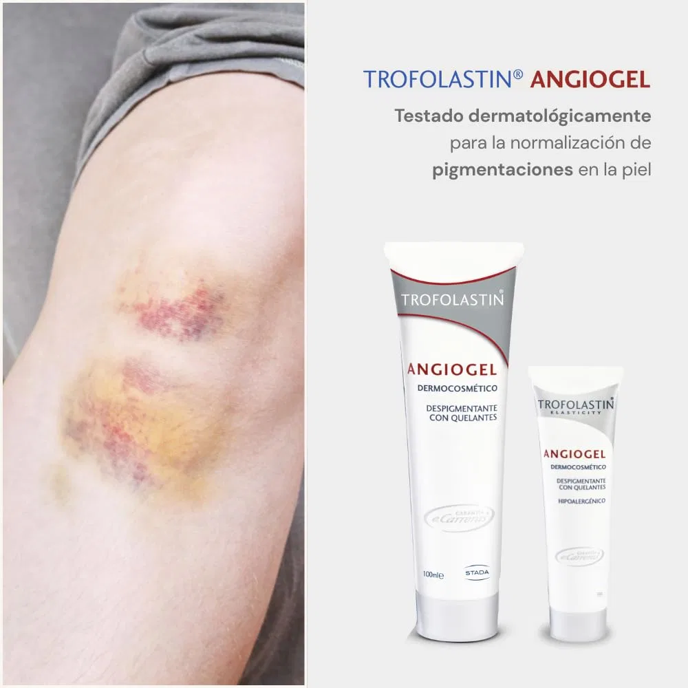 Депигментирующий гель Trofolastin Angiogel Trofolastin — фото 3
