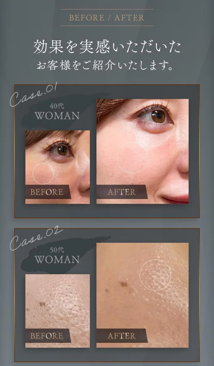 Дневной крем Umbilical Premium Aging Care All-in-One Cream, 30 мл — фото 2