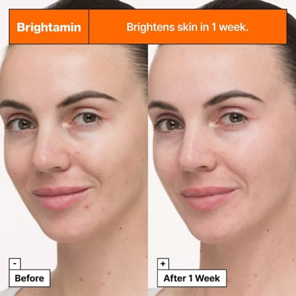 Сыворотка Dr. Jart+ — Brightamin осветляющая с ниацинамидом и витамином С Dr. Jart — фото 2