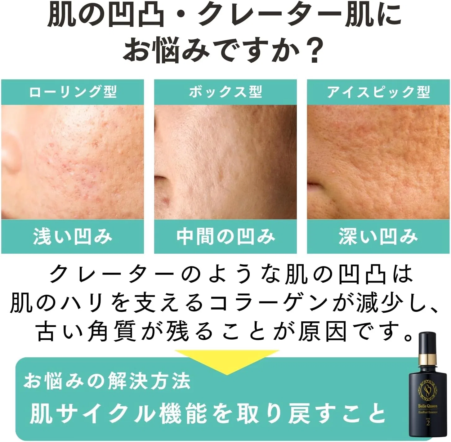 Сыворотка Doctor Re9 — Для лица BellQueen Exopil Skin Care Serum, 4.5 мл — фото 2
