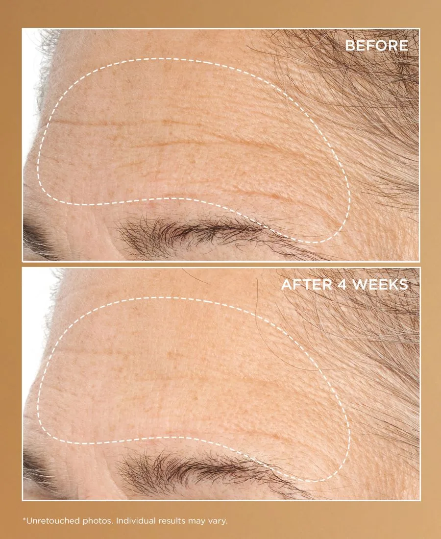 Perricone MD Сыворотка для глубокого разглаживания морщин Neuropeptide Deep Crease Serum, 1 унция — фото 4