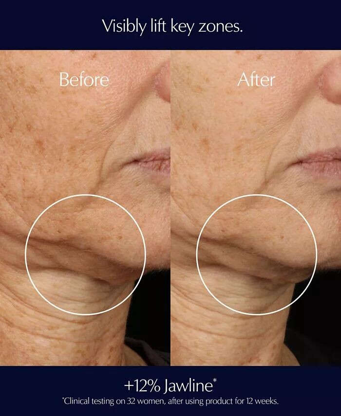 2 шт. Perfectionist Pro Rapid Firm + Набор сывороток-лифтинг Estée Lauder — фото 4