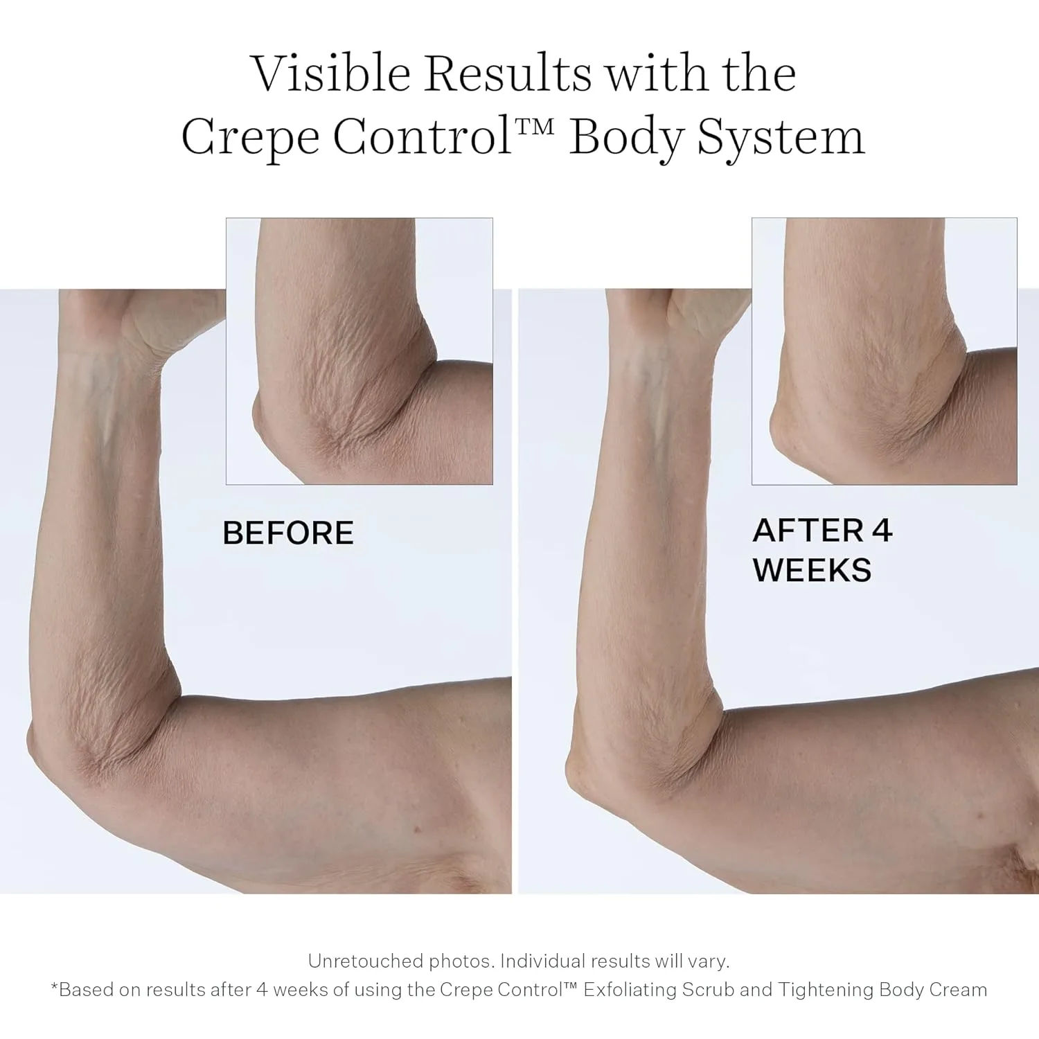 Крем для тела StriVectin Crepe Control Tightening Body Cream Jumbo 283.50 г (1 шт.) — фото 4