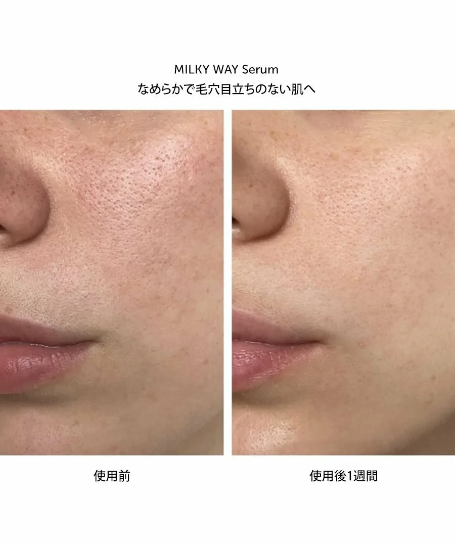 Сыворотка Herbivore Botanicals — Milkyway Clear Peel Serum/Веганская - на растительной основе , ONE — фото 4