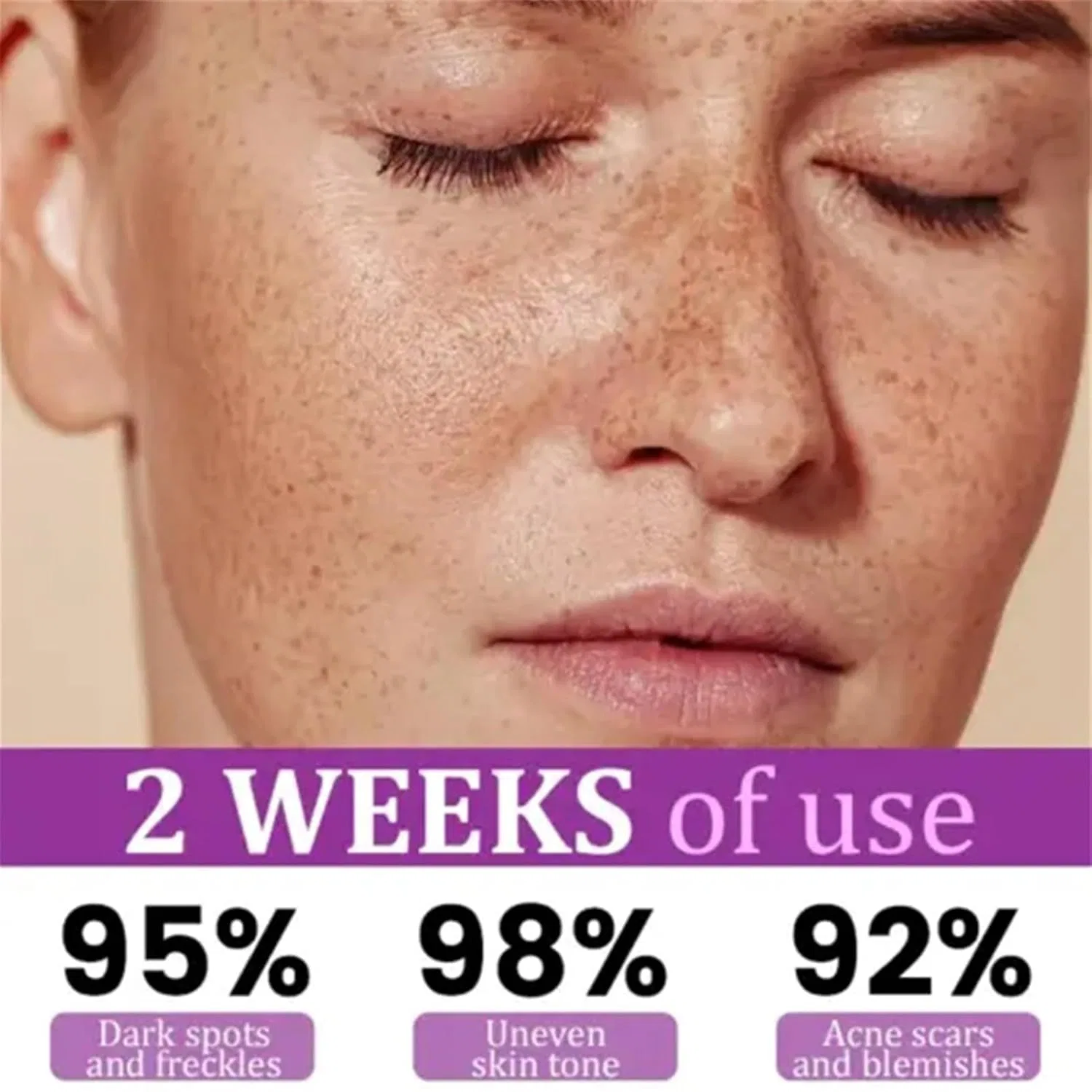 Сыворотка — Anti Pigment Advanced Skin Care Generisch, 30 мл — фото 3