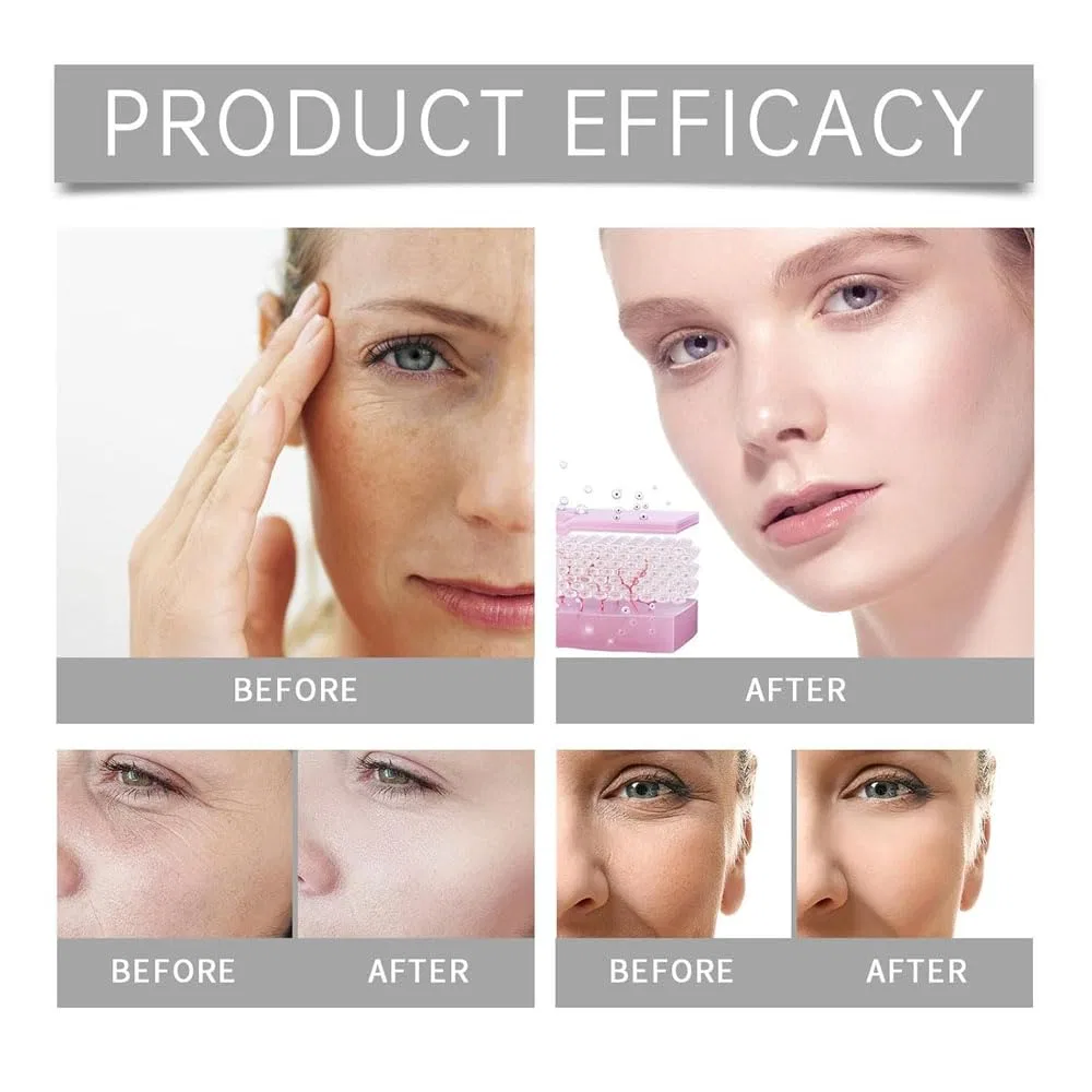 Система микроинфузии для лица Miski Cosmetics Seranuve Original Generisch — фото 4