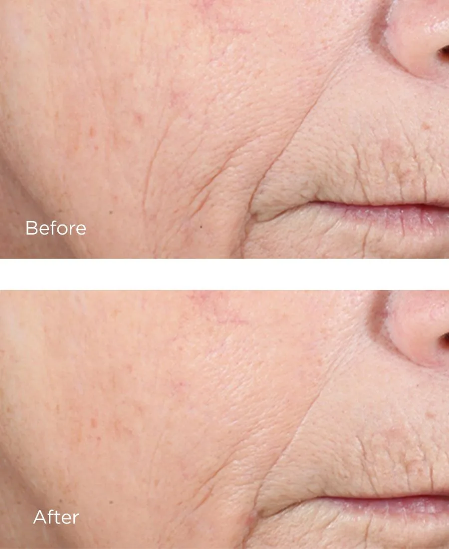 Сыворотка Perricone Md — Комплекс для осветления кожи с эфиром витамина С CCC+ и феруловой кислотой %, 57 г — фото 2