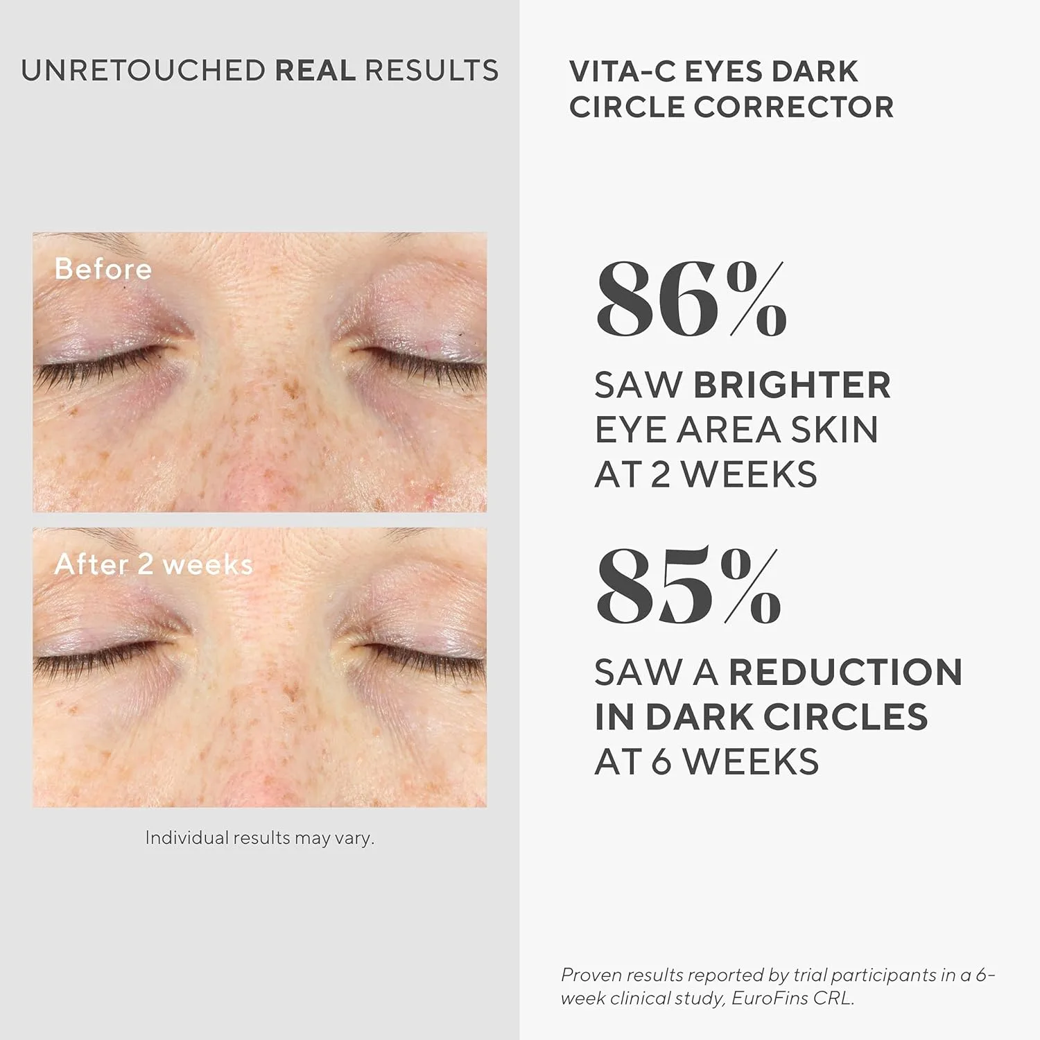 Murad Vita-C Eyes Dark Circle Corrector - сыворотка для глаз с золотом, витамином C, водорослями и огурцом для осветления, уменьшения отечности и разглаживания морщин, 15 мл — фото 3