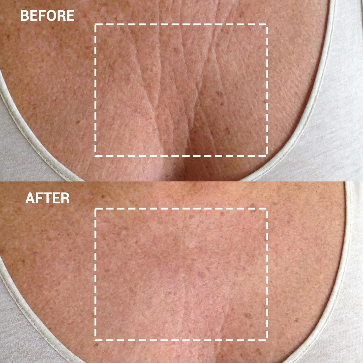 Wrinkles Schminkles патчи от морщин и растяжек для груди, декольте и тела, многоразовые гипоаллергенные силиконовые подушечки для профилактики и уменьшения морщин и растяжек, 2 шт упаковка 2 шт. — фото 3