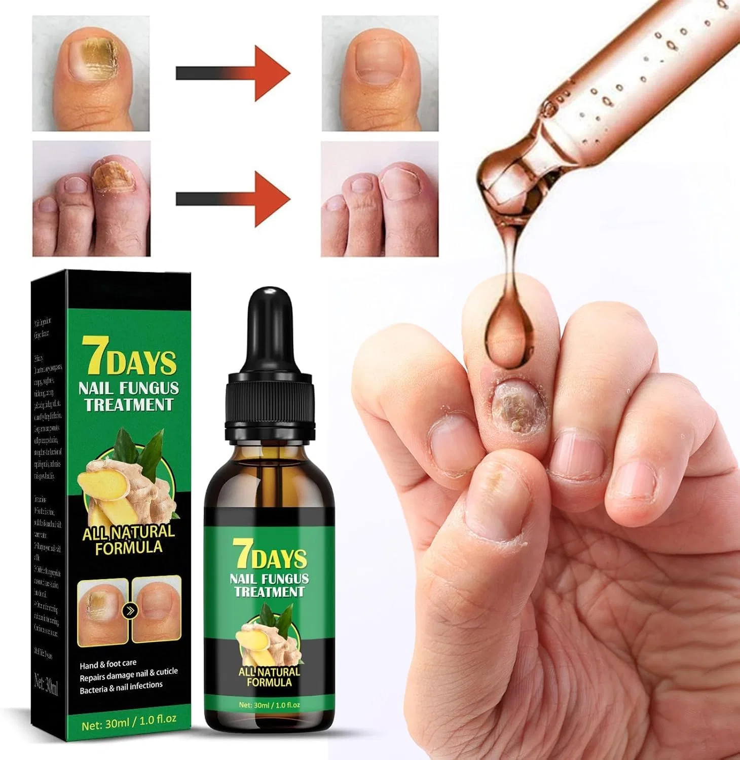 Сыворотка для роста ногтей с имбирем 7 Days Ginger Nail, 3 шт. Ylbhyirsjf — фото 3