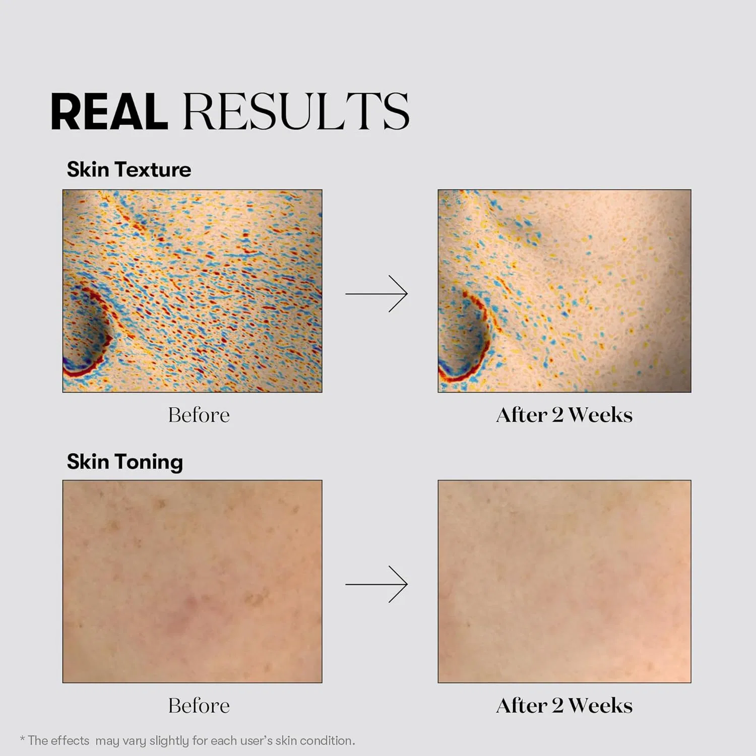 Крем для лица VT Cosmetics — Тонизирующий «TX Toning» от — фото 4