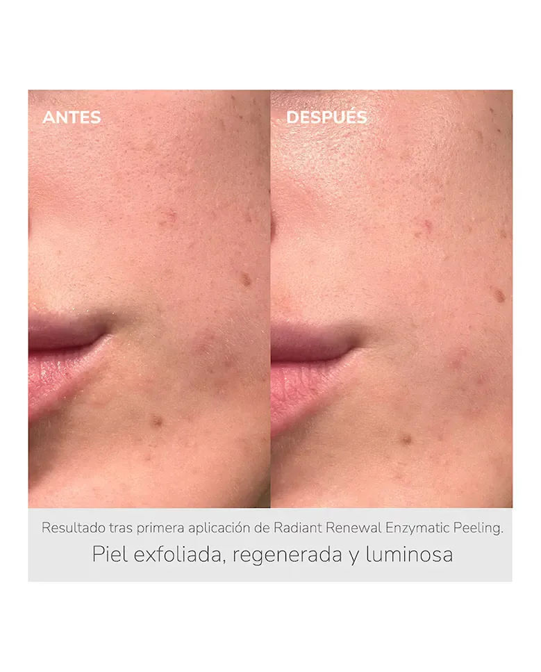 Скраб Nieves By Nieves Álvarez — Энзимный Radiant Renewal Enzymatic Peeling — фото 4