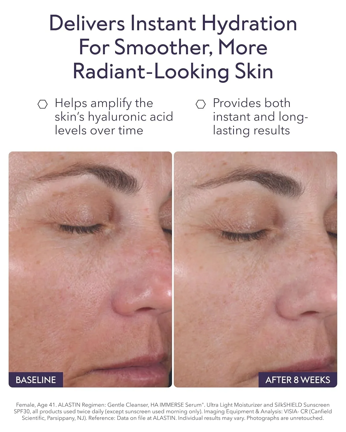 Сыворотка Alastin Skincare — Увлажняющая для лица с гиалуроновой кислотой HA IMMERSE | Восстанавливающая , борется с, 30 мл — фото 4