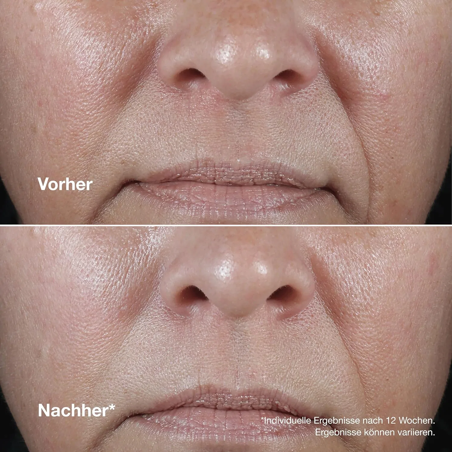 Крем для лица SPF CLINIQUE «Smart Clinical Repair Wrinkle Correcting Rich Cream» от — фото 4