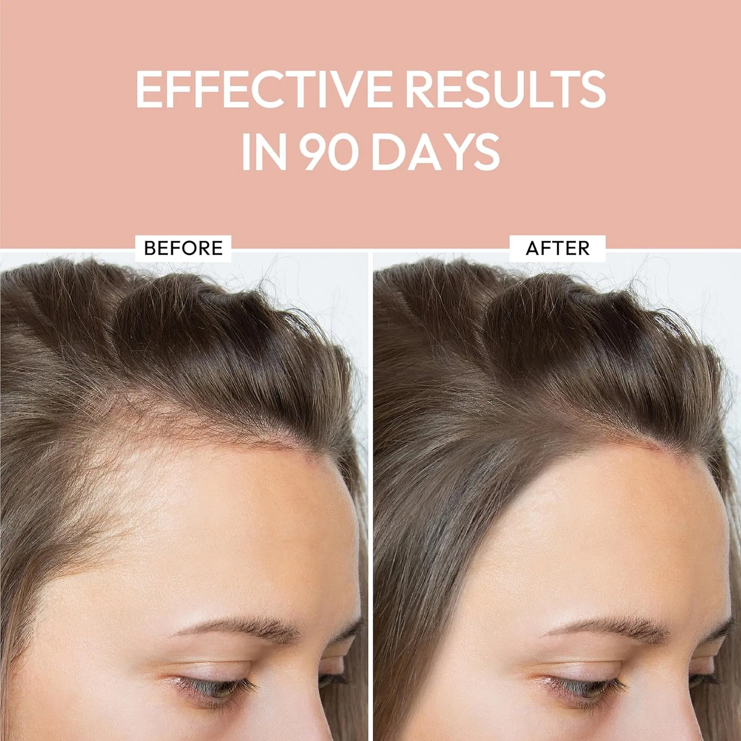 Сыворотка для роста волос «Hair Growth Serum» от Luxe Cosmetics Luxe Cosmetics — фото 2
