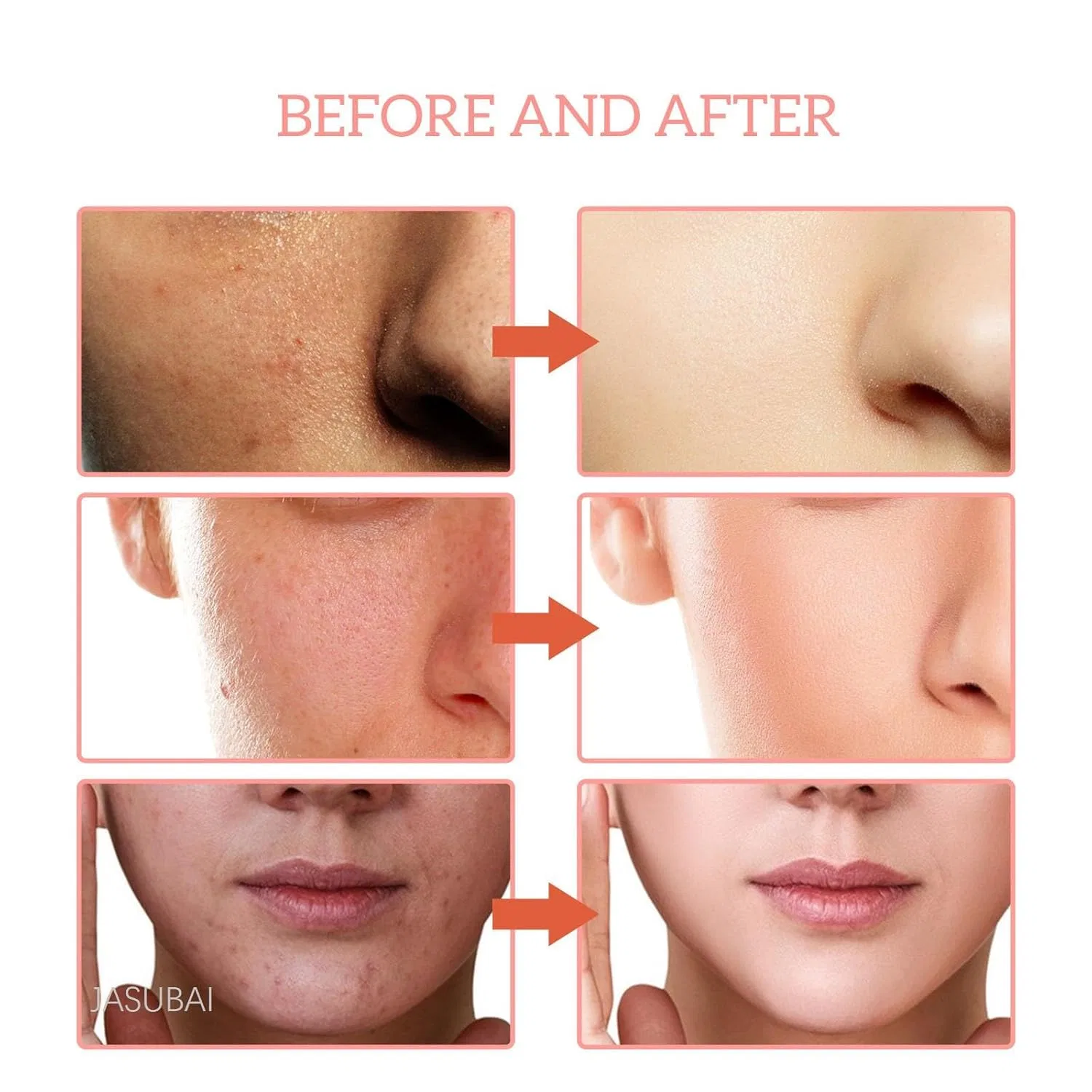 Эссенция ‎Jasubai — Для лица Finones Skin Vitamin Serum -в-1 Jasubai, 3 Pieces, 30 мл — фото 3