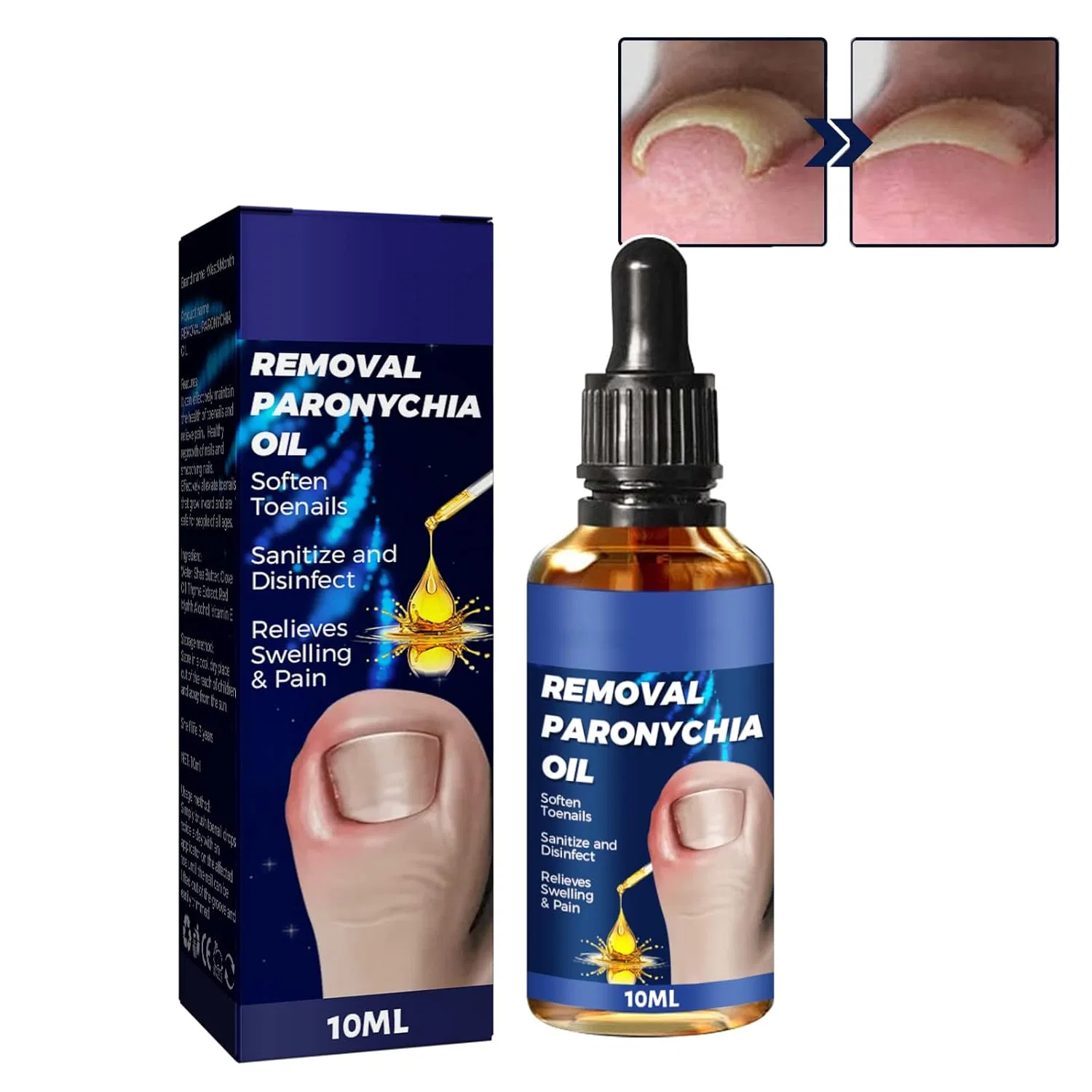 Масло German Toenailcare Removal Paronychia Oil для ухода за ногтями, 10 мл Sovtay, 1Pcs
