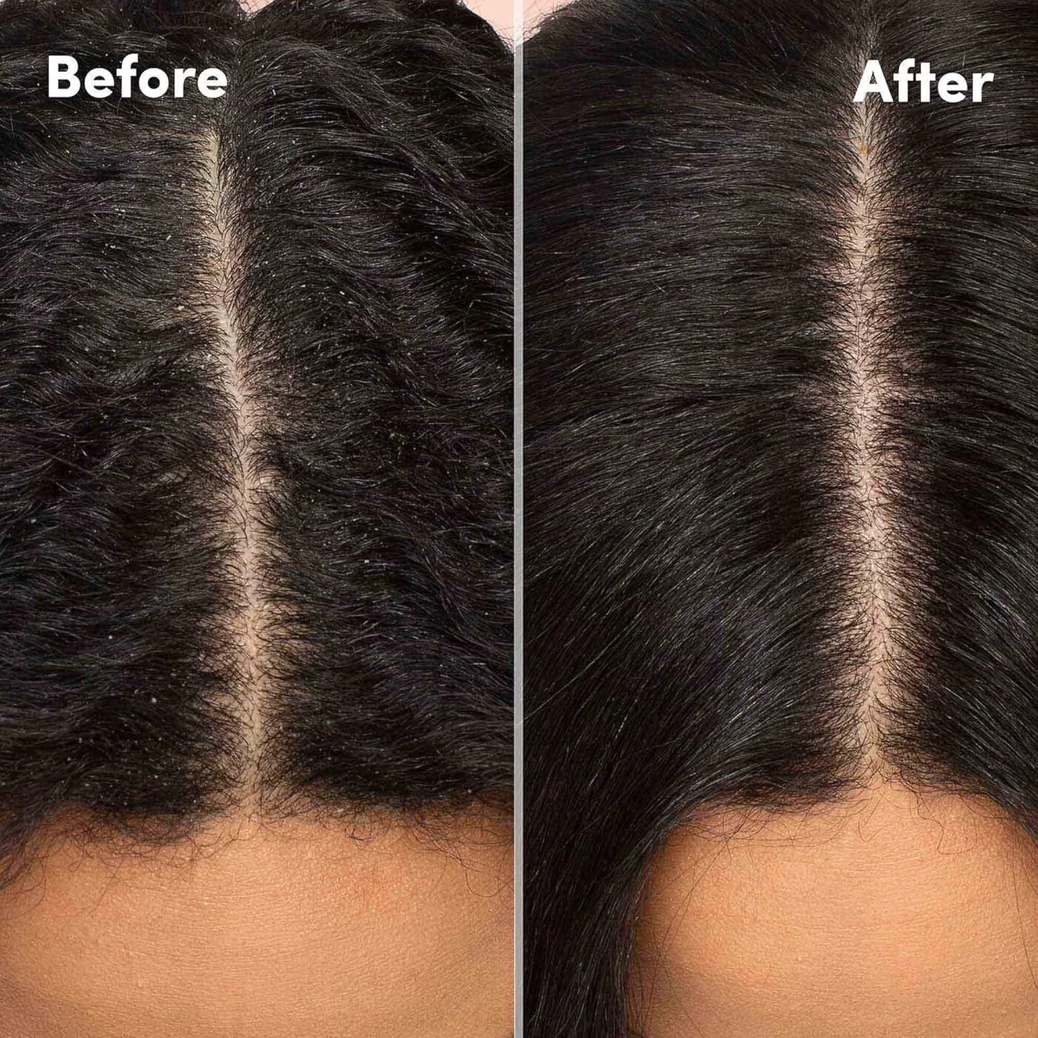 Успокаивающий лосьон для кожи головы Mizani Scalp Care - средство от перхоти, против шелушения, с эвкалиптом, маслом авокадо и ментолом, без силиконов и парабенов. — фото 4