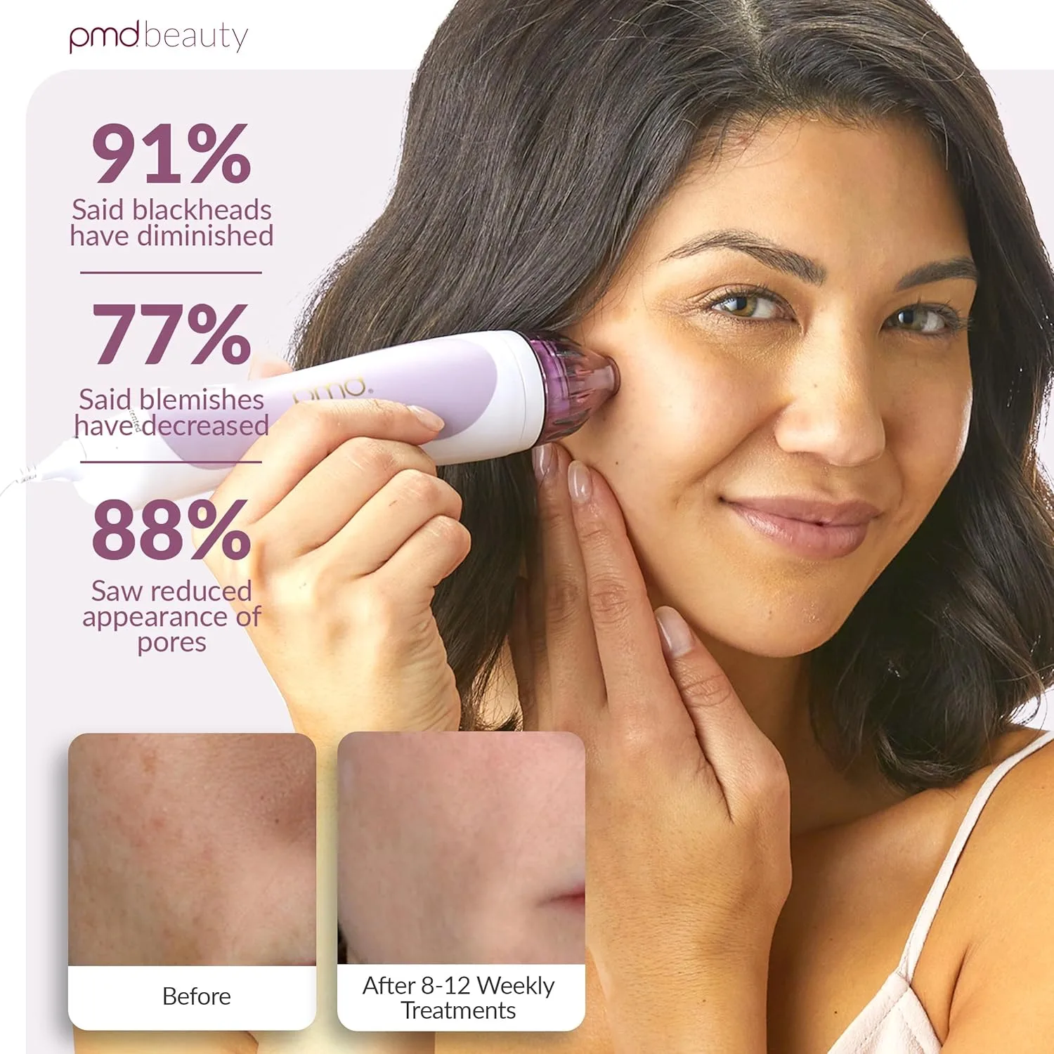PMD Beauty Personal Microderm Classic - Набор для домашнего использования, инструмент для отшелушивания кожи лица, микродермабразия для ухода за кожей лица и тела., Lavender — фото 4