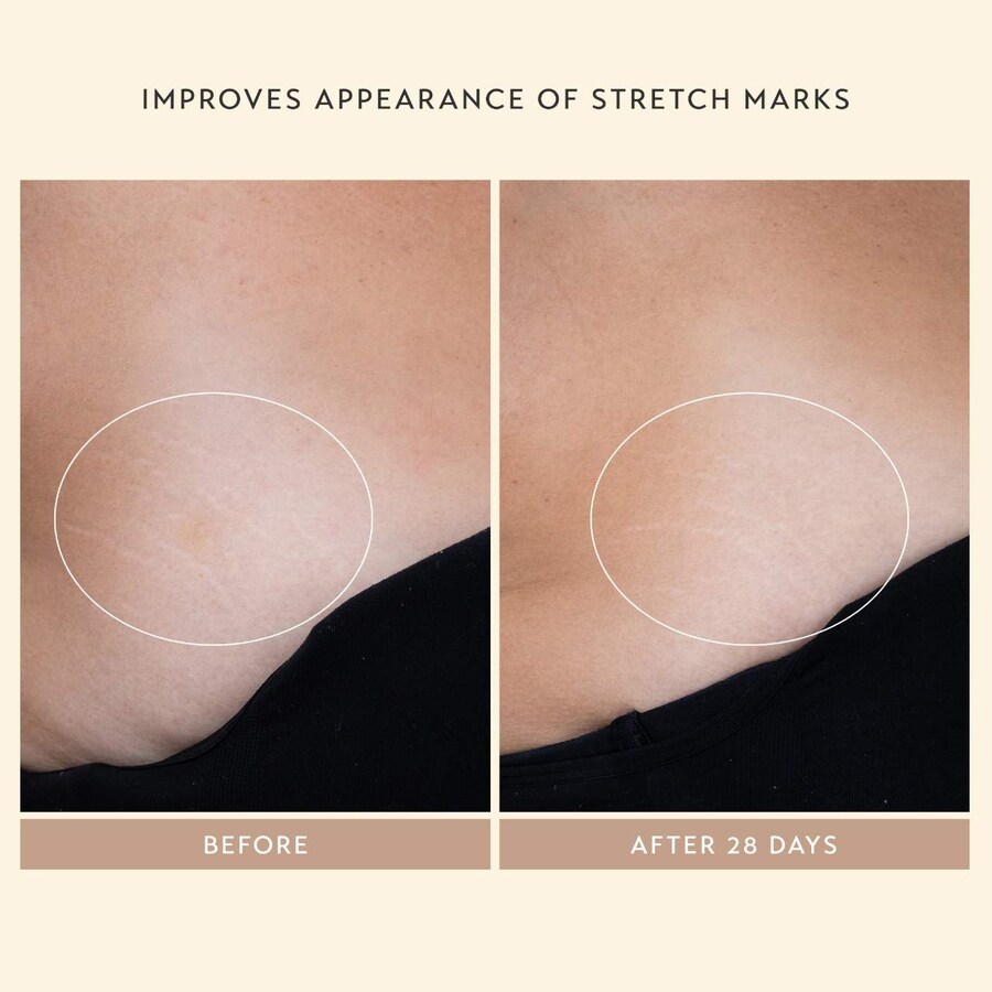 Сыворотка Shani Darden Skin Care — Для тела Body Reform Treatment Serum с % гранулятивным ретиноидом, 120 мл — фото 4