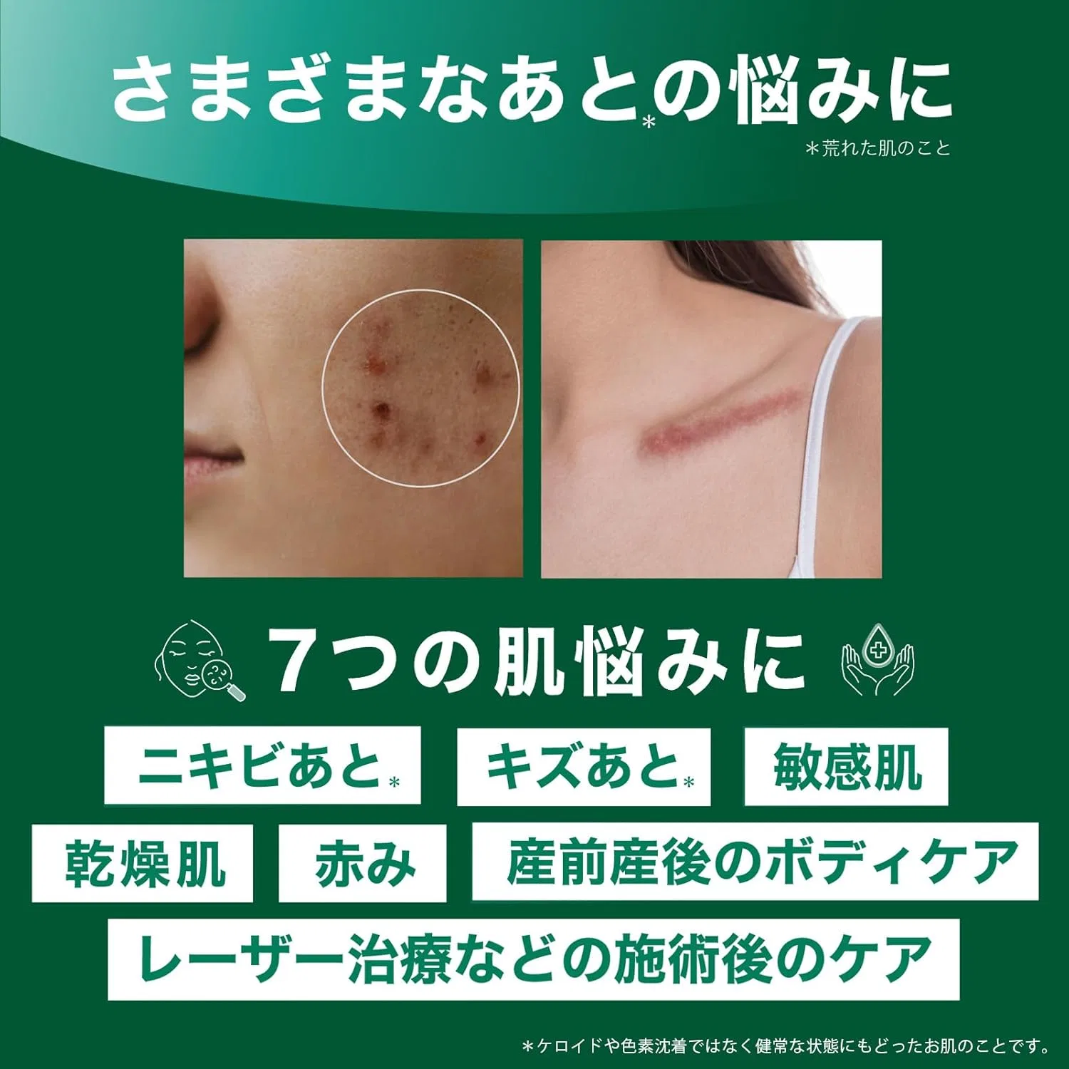Крем для лица Smooth E — Дневной Cream, 15 г — фото 2