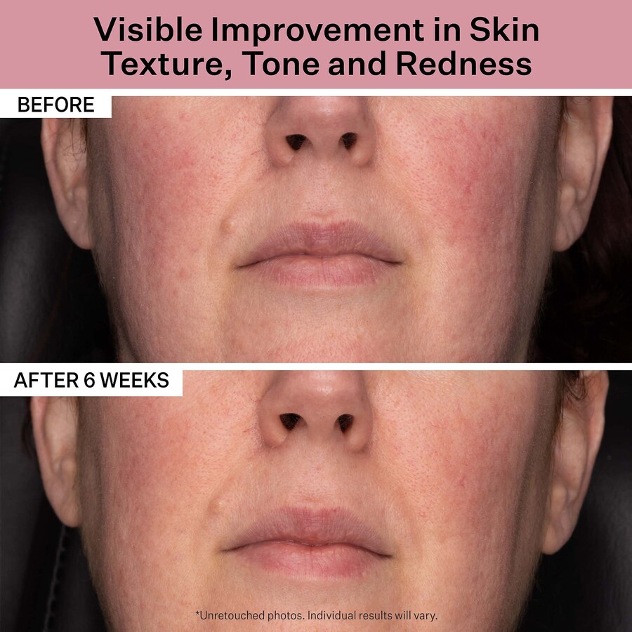 Увлажняющий крем для лица Advanced Retinol Daily Repair с широким спектром защиты SPF 30 StriVectin, 1.7 oz/50 mL — фото 2