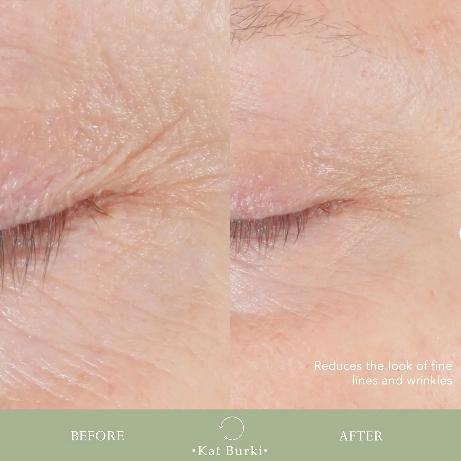 Сыворотка Kat Burki — Для лица Form Control Marine Collagen. Клинически доказанный антивозрастной уход, 29.6 мл — фото 4