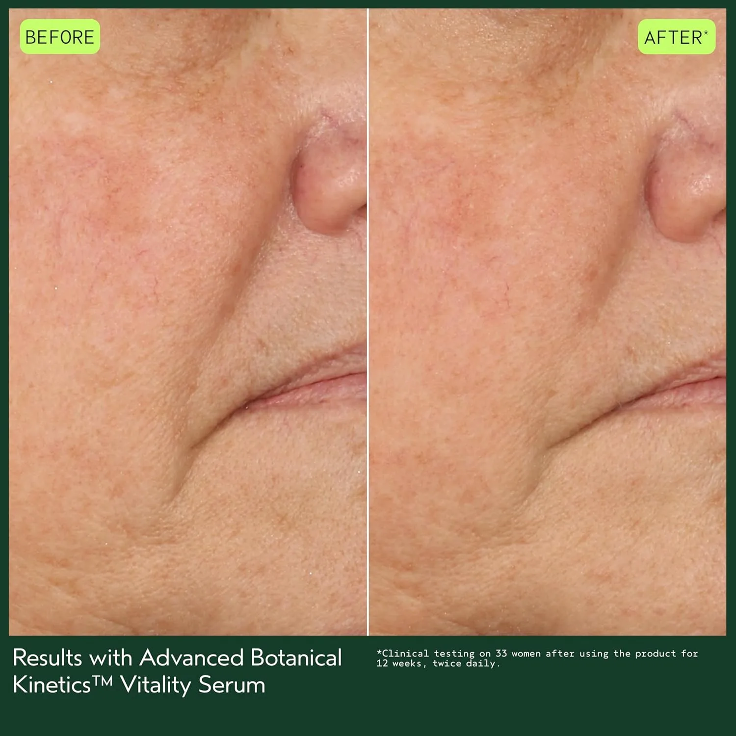 Сыворотка Aveda — Для повышения жизненной энергии Advanced Botanical Kinetics Vitality Serum | Уменьшает, 30 мл — фото 3