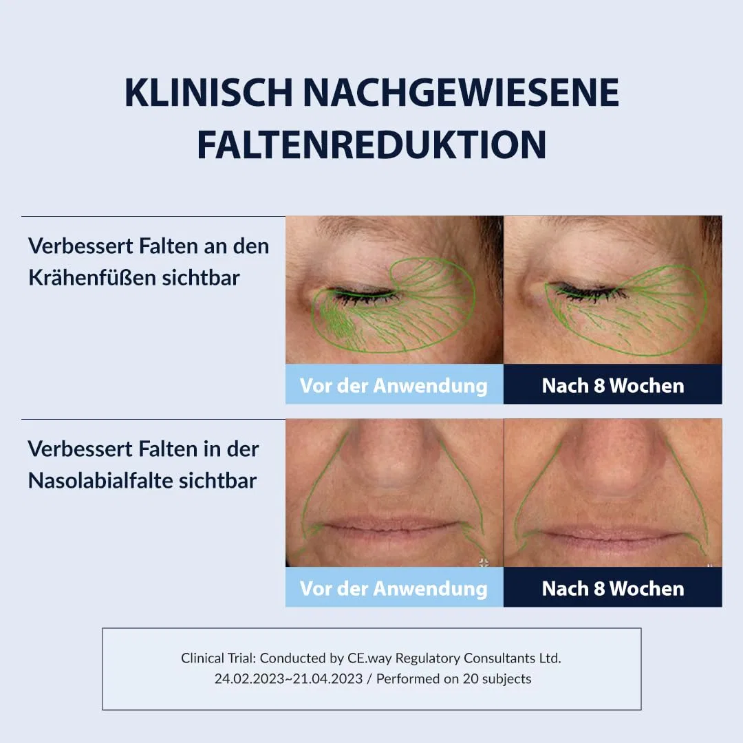 Крем для лица Mizon — Антивозрастной «Retinol Youth Cream» . % от — фото 4