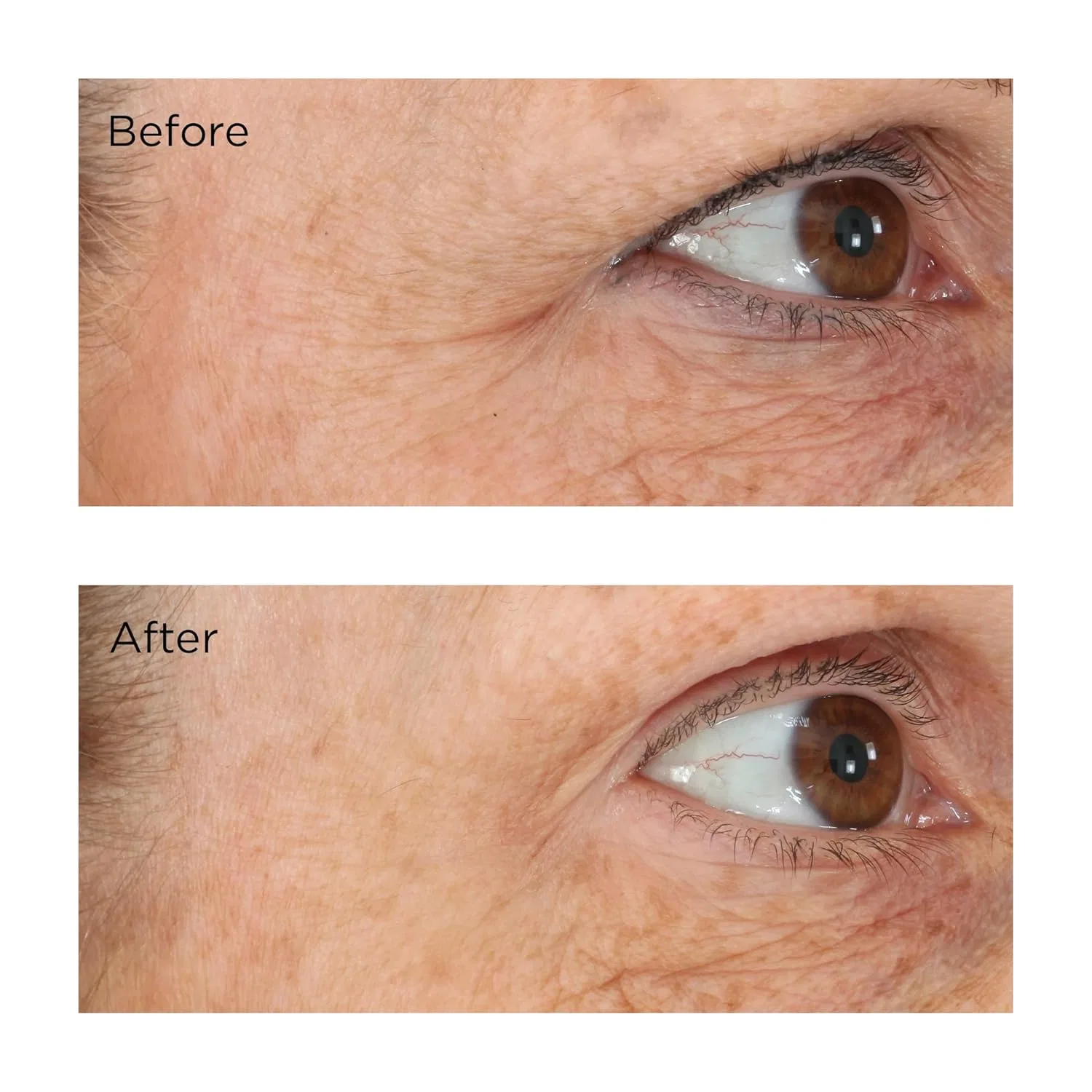 Сыворотка для век Essential Fx Acyl-Glutathione Eyelid Lift Serum от Perricone MD, 30 мл Perricone Md — фото 4