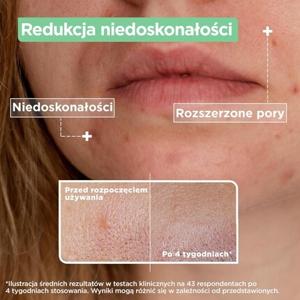 Сыворотка Mixa — Для лица против несовершенств с салициловой кислотой и ниацинамидом — фото 3