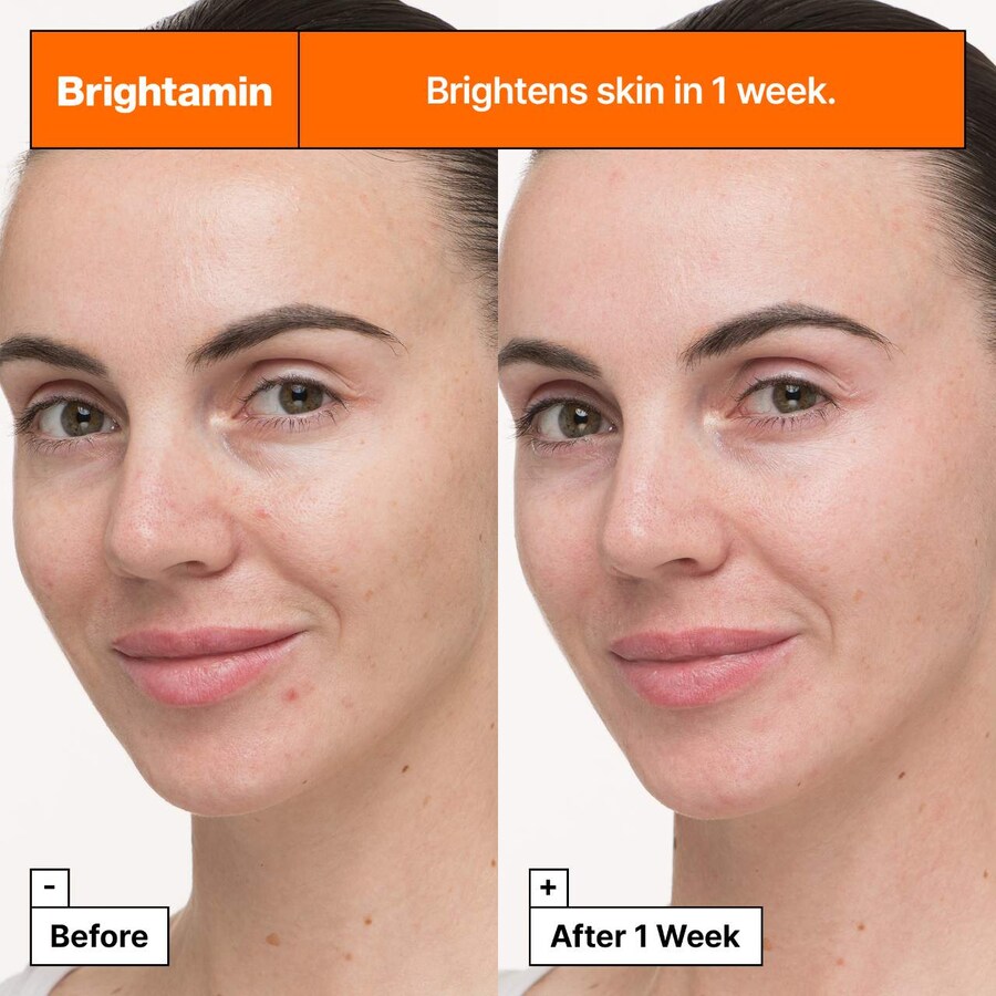 Сыворотка Dr. Jart+ — Осветляющая Brightamin с ниацинамидом и витамином С, 8 г — фото 2