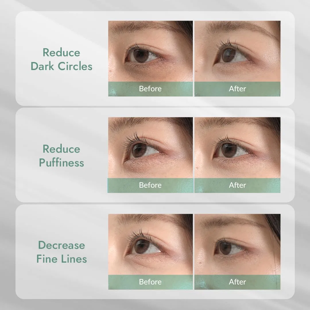 Гелевые патчи для глаз «Cicaluronic Eye Gel Patch» с центеллой и гиалуроновой кислотой от MIZON Mizon, Cicaluronic — фото 3