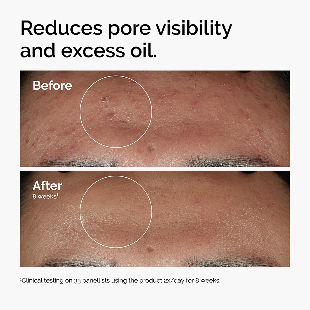 Сыворотка The Ordinary — Для лица Niacinamide % + Zinc % — фото 3