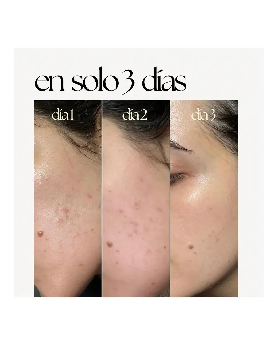 Сыворотка Elisabeth Álvarez Cosmetics — Skin Correct, 30 мл — фото 4