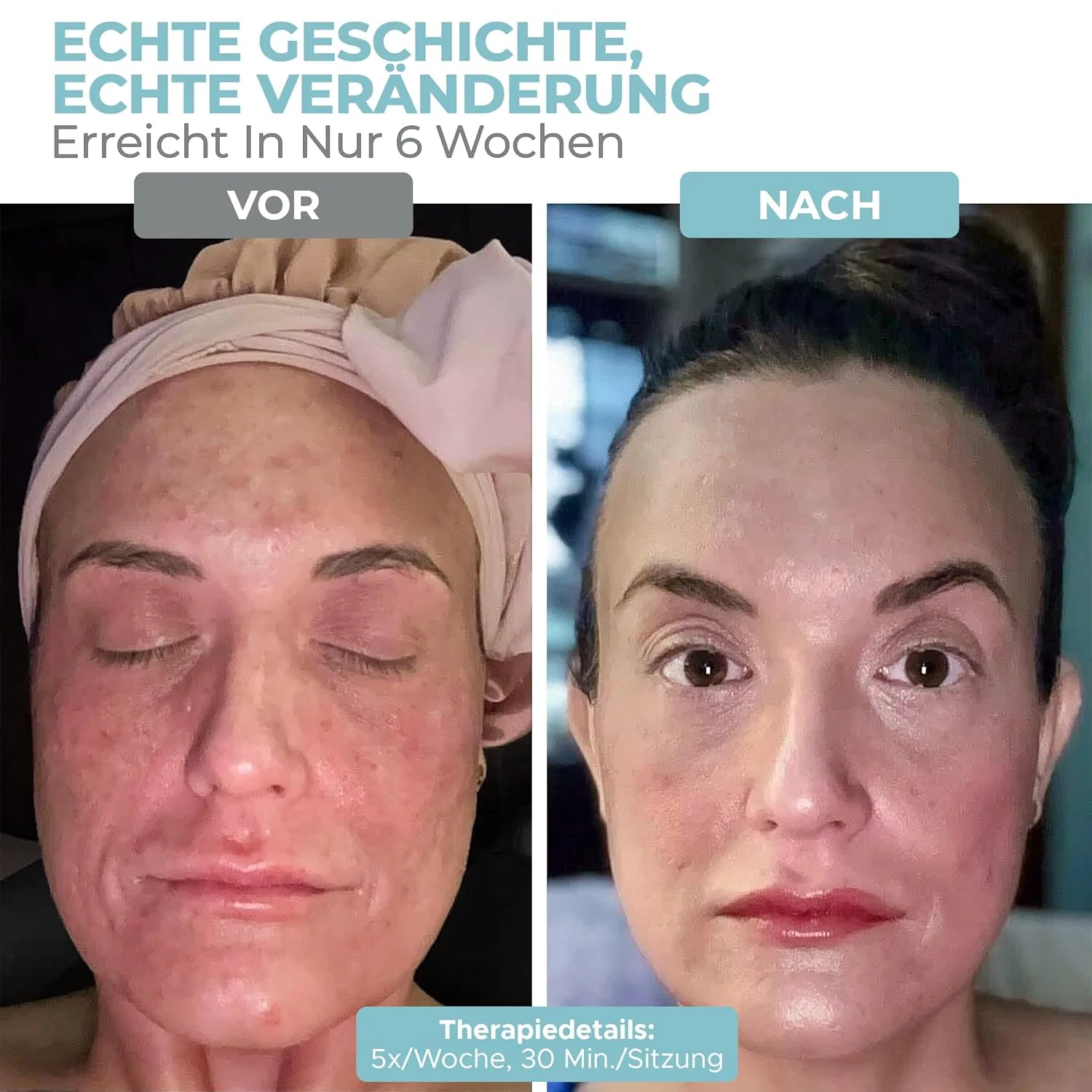 Маска для лица Nourished Bodynskin — Цветная светодиодная с ближним инфракрасным светом от — фото 4