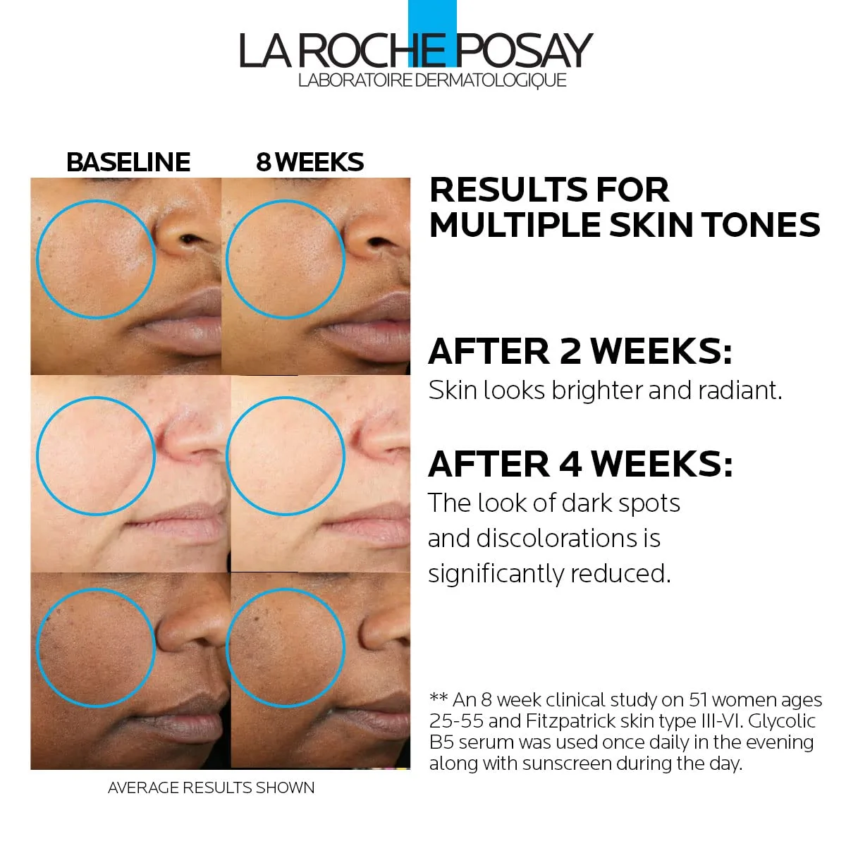 Сыворотка La Roche-Posay — С гликолевой кислотой, транексамовой кислотой, койевой кислотой и витамином B5 уменьшает — фото 2