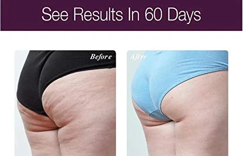 Сыворотка для тела Osmotics Anti-Aging Body Lift, обладающая антивозрастным эффектом, подтягивает грудь, живот и ягодицы, обеспечивая видимый эффект лифтинга. Рекомендована дерматологами. Osmotics Cosmeceuticals — фото 2
