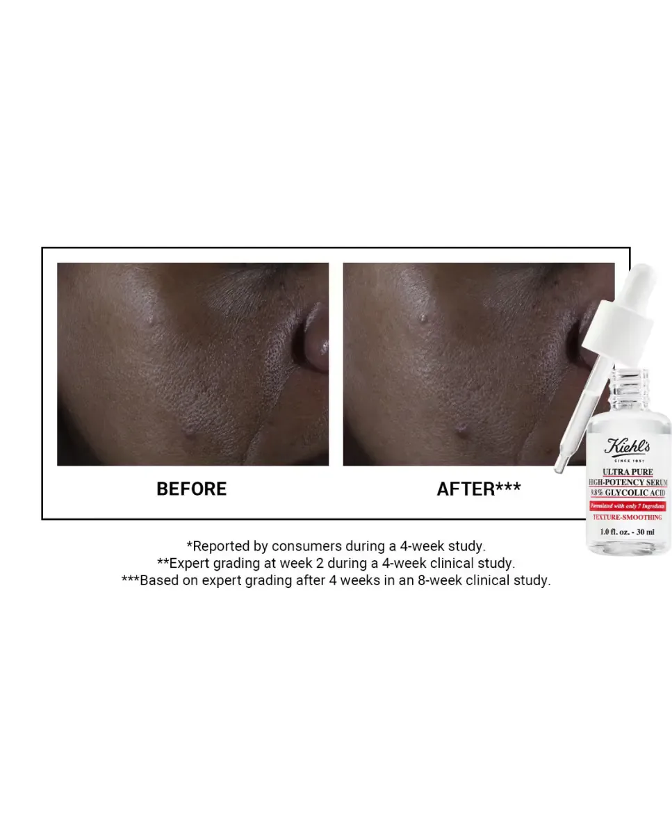 Сыворотка Kiehl's — С гликолевой кислотой Ultra Pure высокой концентрации — фото 4
